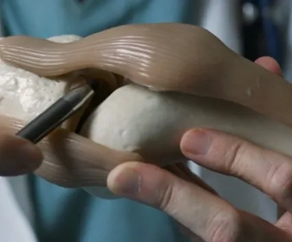 Hands pointing a pen at a model of a knee joint