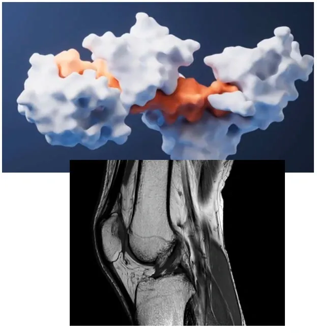 3D protein model floating above a knee MRI